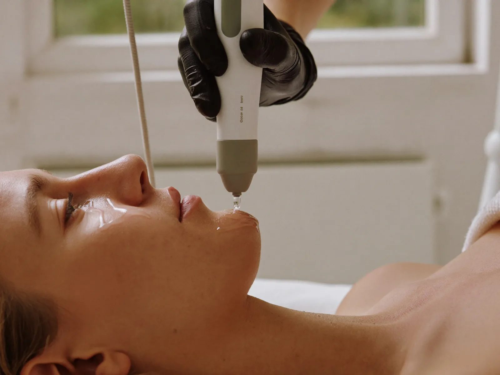 Microneedling
